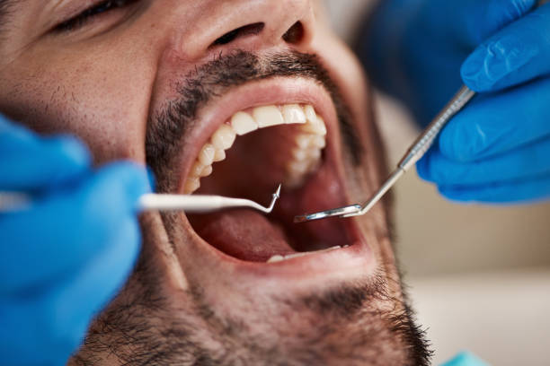 Best Mobile Emergency Dentist in Marceline, MO